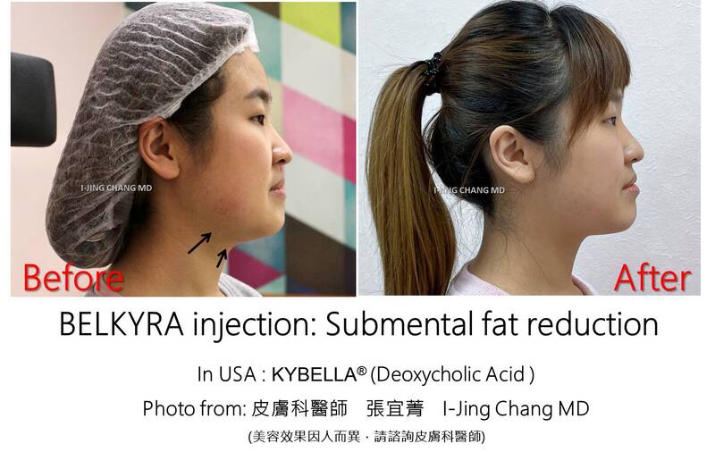 injection before and after