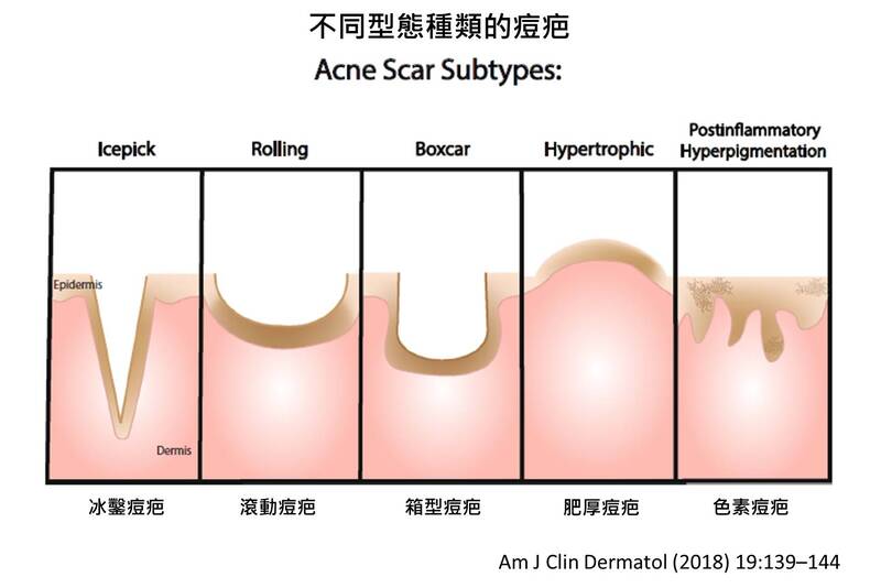 laser before and after