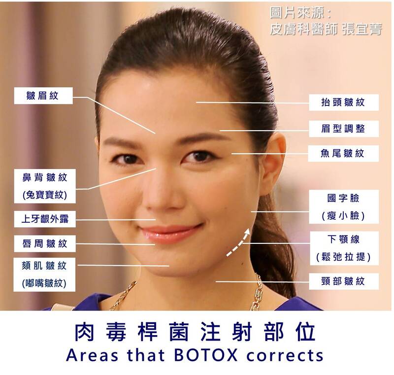肉毒桿菌素